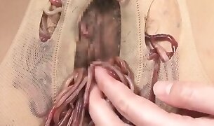 worms